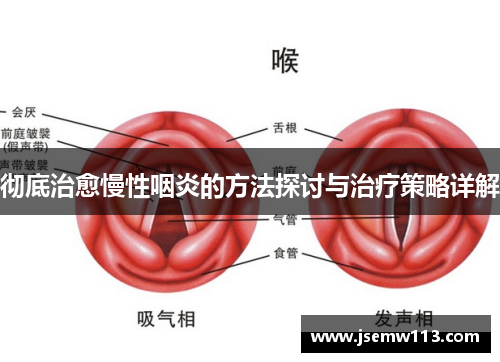 彻底治愈慢性咽炎的方法探讨与治疗策略详解