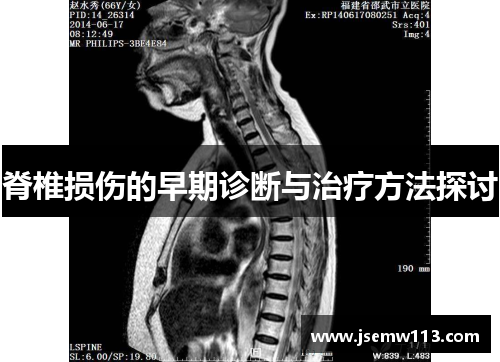 脊椎损伤的早期诊断与治疗方法探讨
